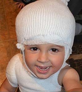 boy with burn bandages on head